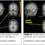 Baby Stimuli and the Parent Brain: Functional Neuroimaging of the Neural Substrates of Parent-Infant Attachment